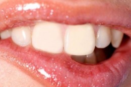 Jak dieta wpływa na zęby?